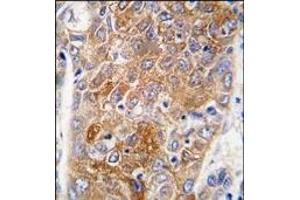 Image no. 2 for anti-Aldehyde Dehydrogenase 1 Family, Member L1 (ALDH1L1) (AA 724-754), (C-Term) antibody (ABIN360201)