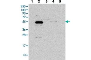 Western blot analysis of Lane 1: RT-4, Lane 2: U-251 MG, Lane 3: Human Plasma, Lane 4: Liver, Lane 5: Tonsil with C12orf34 polyclonal antibody  at 1:250-1:500 dilution. (FAM222A Antikörper)