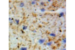 Used in DAB staining on fromalin fixed paraffin-embedded Brain tissue (GSTA4 Antikörper  (AA 3-222))