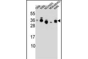 SSX4 Antibody (Center) (ABIN657137 and ABIN2837900) western blot analysis in CEM,K562,NCI-,MDA-M,A549 cell line lysates (35 μg/lane). (SSX4 Antikörper  (AA 63-91))