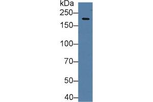 Western blot analysis of Mouse Cerebrum lysate, using Human HIF2a Antibody (2 µg/ml) and HRP-conjugated Goat Anti-Rabbit antibody ( (EPAS1 Antikörper  (AA 339-541))
