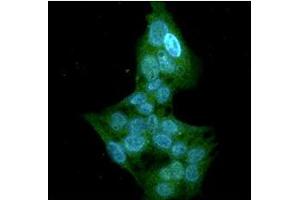 ICC/IF analysis of GSTT1 in HepG2 cells line, stained with DAPI (Blue) for nucleus staining and monoclonal anti-human GSTT1 antibody (1:100) with goat anti-mouse IgG-Alexa fluor 488 conjugate (Green).