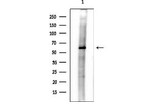 anti-Membrane Bound O-Acyltransferase Domain Containing 1 (MBOAT1) antibody