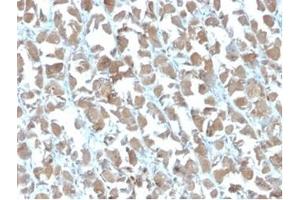 Immunohistochemistry (IHC) image for anti-MHC Class I Polypeptide-Related Sequence A (MICA) (AA 1-200) antibody (ABIN7504179)