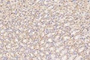 Immunohistochemistry (Paraffin-embedded Sections) (IHC (p)) image for anti-NCK Associated Protein 1 (NCKAP1) antibody (ABIN7074784)