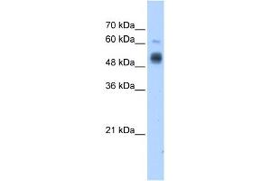GCNT3 antibody used at 1. (GCNT3 Antikörper)