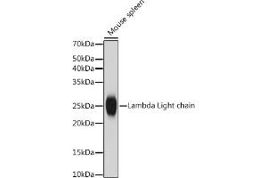 Western blot analysis of extracts of Mouse spleen, using Lambda Light chain antibody (ABIN7267847) at 1:1000 dilution. (IGLV1-51 Antikörper)
