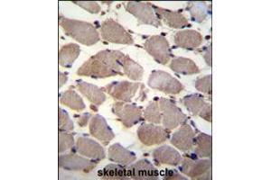 PIK3C2A Antibody immunohistochemistry analysis in formalin fixed and paraffin embedded human skeletal muscle followed by peroxidase conjugation of the secondary antibody and DAB staining. (PIK3C2A Antikörper  (C-Term))