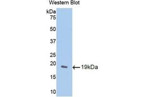 Western blot analysis of the recombinant protein. (WISP1 Antikörper  (AA 213-350))