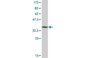 Western Blot detection against Immunogen (36. (COQ8A Antikörper  (AA 1-100))