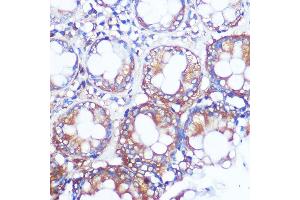 Immunohistochemistry of paraffin-embedded human colon using Collagen X/COL10 Rabbit pAb (8604) at dilution of 1:100 (40x lens).