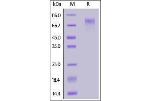 Human CD34, His Tag on  under reducing (R) condition. (CD34 Protein (CD34) (AA 32-290) (His tag))
