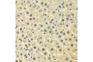 Immunohistochemistry of paraffin-embedded rat liver using SPHK1 Antibody (ABIN5970017) at dilution of 1/100 (40x lens). (SPHK1 Antikörper)