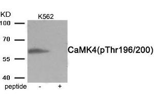 Western blot analysis of extracts from K562 cells treated with H2O2 using Phospho-CaMK4 (Thr196/200) antibody. (CAMK4 Antikörper  (pThr196, pThr200))