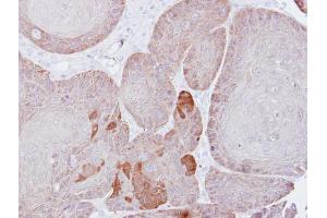 IHC-P Image Immunohistochemical analysis of paraffin-embedded Cal27 xenograft, using Proteasome 26S S3, antibody at 1:500 dilution. (Proteasome 26S S3 (Center) Antikörper)