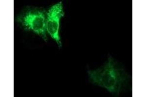 Immunofluorescence (IF) image for anti-ADAM Metallopeptidase with thrombospondin Type 1 Motif, 8 (ADAMTS8) antibody (ABIN2715723) (ADAMTS8 Antikörper)