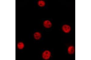ABIN6277089 staining  Hela cells by IF/ICC. (PIN1 Antikörper  (N-Term))