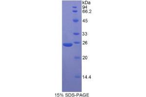 MYH8 Protein