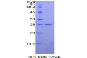 SDS-PAGE analysis of Mouse APC Protein. (APC Protein)