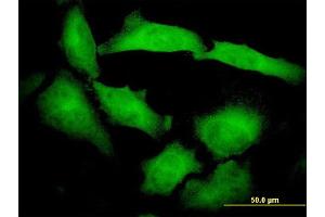 Immunofluorescence of monoclonal antibody to PCDHB10 on HeLa cell. (PCDHB10 Antikörper  (AA 27-125))