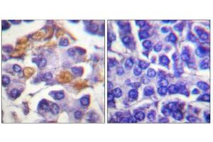 Immunohistochemistry (IHC) image for anti-V-Raf-1 Murine Leukemia Viral Oncogene Homolog 1 (RAF1) (pTyr341) antibody (ABIN1847298) (RAF1 Antikörper  (pTyr341))