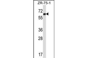 DCTN4 Antibody (N-term) (ABIN657377 and ABIN2846423) western blot analysis in ZR-75-1 cell line lysates (35 μg/lane). (Dynactin 4 Antikörper  (N-Term))