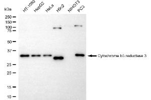 Western blotting analysis using cytochrome b5 reductase 3 antibody (ABIN7798244). (Rekombinanter CYB5R3 Antikörper)