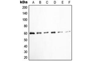 Western blot analysis of c-SRC (pY529) expression in K562 (A), HuvEc (B), Jurkat (C), COLO205 (D), HEK293T EGF-treated (E), A431 pervanadate-treated (F) whole cell lysates. (Src Antikörper  (C-Term, pTyr529))