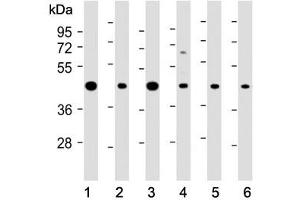 Western Blotting (WB) image for anti-Argininosuccinate Synthase 1 (ASS1) (AA 192-221) antibody (ABIN3030022)