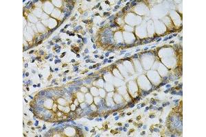 Immunohistochemistry of paraffin-embedded Human colon using GSTM2 Polyclonal Antibody at dilution of 1:100 (40x lens).