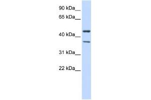 WB Suggested Anti-KCNJ4 Antibody Titration:  0. (KCNJ4 Antikörper  (Middle Region))