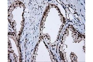 Immunohistochemistry (IHC) image for anti-Amyloid beta (A4) Precursor Protein (APP) antibody (ABIN1496879) (APP Antikörper)