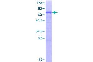 RAD51AP1 Protein (AA 1-335) (GST tag)