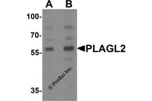 Western Blotting (WB) image for anti-Pleiomorphic Adenoma Gene-Like 2 (PLAGL2) (N-Term) antibody (ABIN1077381) (PLAGL2 Antikörper  (N-Term))