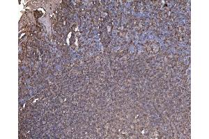 IHC analysis of RAB1B using anti-RAB1B antibody (ABIN7602809). (RAB1B Antikörper  (C-Term))