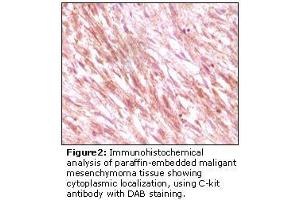 Image no. 2 for anti-Mast/stem Cell Growth Factor Receptor (KIT) antibody (ABIN232128) (KIT Antikörper)