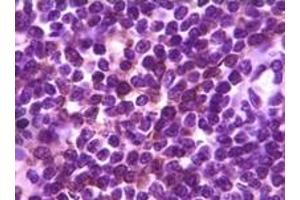 Immunohistochemistry (IHC) image for anti-B Lymphoid Tyrosine Kinase (BLK) (truncated) antibody (ABIN2464018) (BLK Antikörper  (truncated))