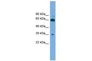 WB Suggested Anti-GLIPR1L1 Antibody Titration: 0.