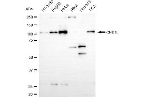 Western blotting analysis using CHD1L antibody (ABIN7798067).