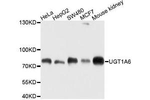Western blot analysis of extracts of various cell lines, using UGT1A6 antibody. (UGT1A6 Antikörper  (AA 65-270))