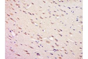 Immunohistochemistry (Paraffin-embedded Sections) (IHC (p)) image for anti-Protein tyrosine Phosphatase, Non-Receptor Type 11 (PTPN11) (pTyr81) antibody (ABIN712541)