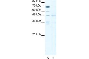 WB Suggested Anti-TBX5 Antibody   Titration: 5 ug/ml   Positive Control: HepG2 Whole Cell (T-Box 5 Antikörper  (N-Term))