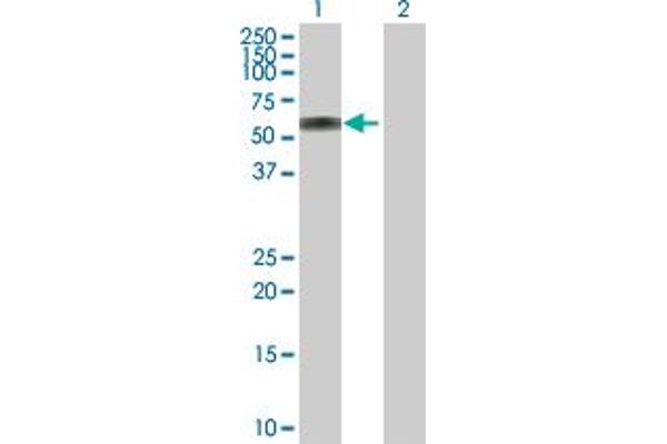 ATP6AP1 Antikörper  (AA 1-470)