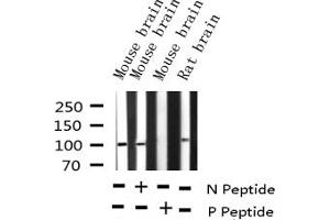 Western blot analysis of Phospho-GluR1 (Ser863) expression in various lysates (Glutamate Receptor 1 Antikörper  (pSer863))