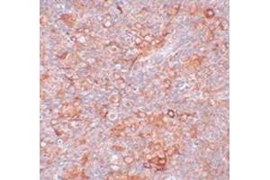 Immunohistochemical staining of mouse thymus tissue with TMEM38B polyclonal antibody  at 5 ug/mL dilution. (TMEM38B Antikörper  (C-Term))