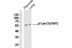 Lane 1: Mouse placenta lysates, Lane 2: Mouse lung lysates probed with Lyn (Tyr397) Polyclonal Antibody, Unconjugated  at 1:300 overnight at 4˚C. (LYN Antikörper  (pTyr397))