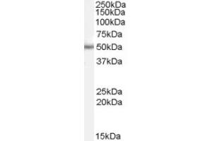Image no. 1 for anti-Paired Box 6 (PAX6) (Internal Region) antibody (ABIN374758) (PAX6 Antikörper  (Internal Region))