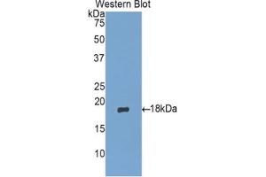 Western blot analysis of the recombinant protein. (MGP Antikörper  (AA 20-103))