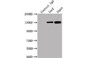 Immunoprecipitating lacZ in 293T transfected whole cell lysate   Lane 1: Mouse control IgG instead of ABIN7141389 in 293T transfected whole cell lysate. (LacZ Antikörper)