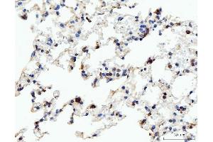 IHC analysis of Acid Phosphatase/ACP5 using anti-Acid Phosphatase/ACP5 antibody (ABIN7601574). (ACP5 Antikörper  (AA 39-325))